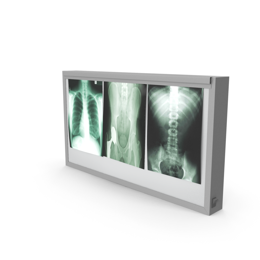Radiologie - Boîte à rayons X - Clinique Pasteur